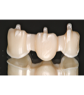 carousel_thumb